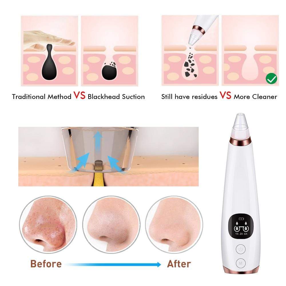 Beauty Blackhead Remover Vacuum Pore Cleaner